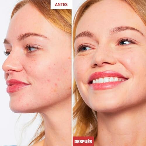 Comparación del rostro antes y después del tratamiento de cuidado facial